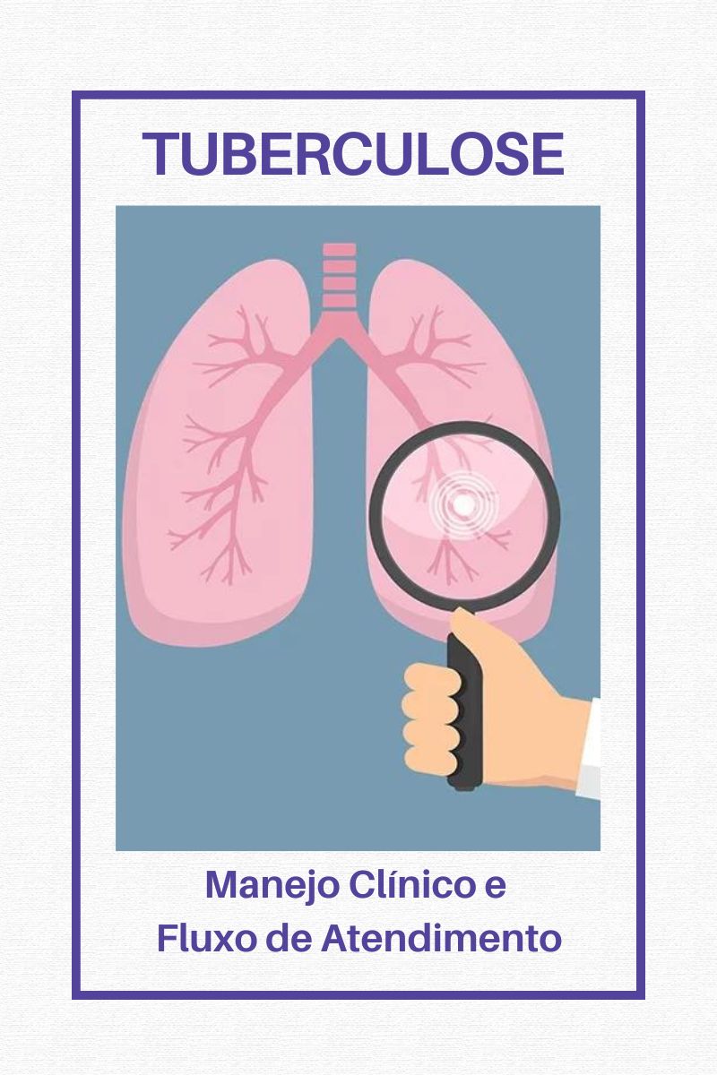 Tuberculose: Manejo Clínico e Fluxo de Atendimento