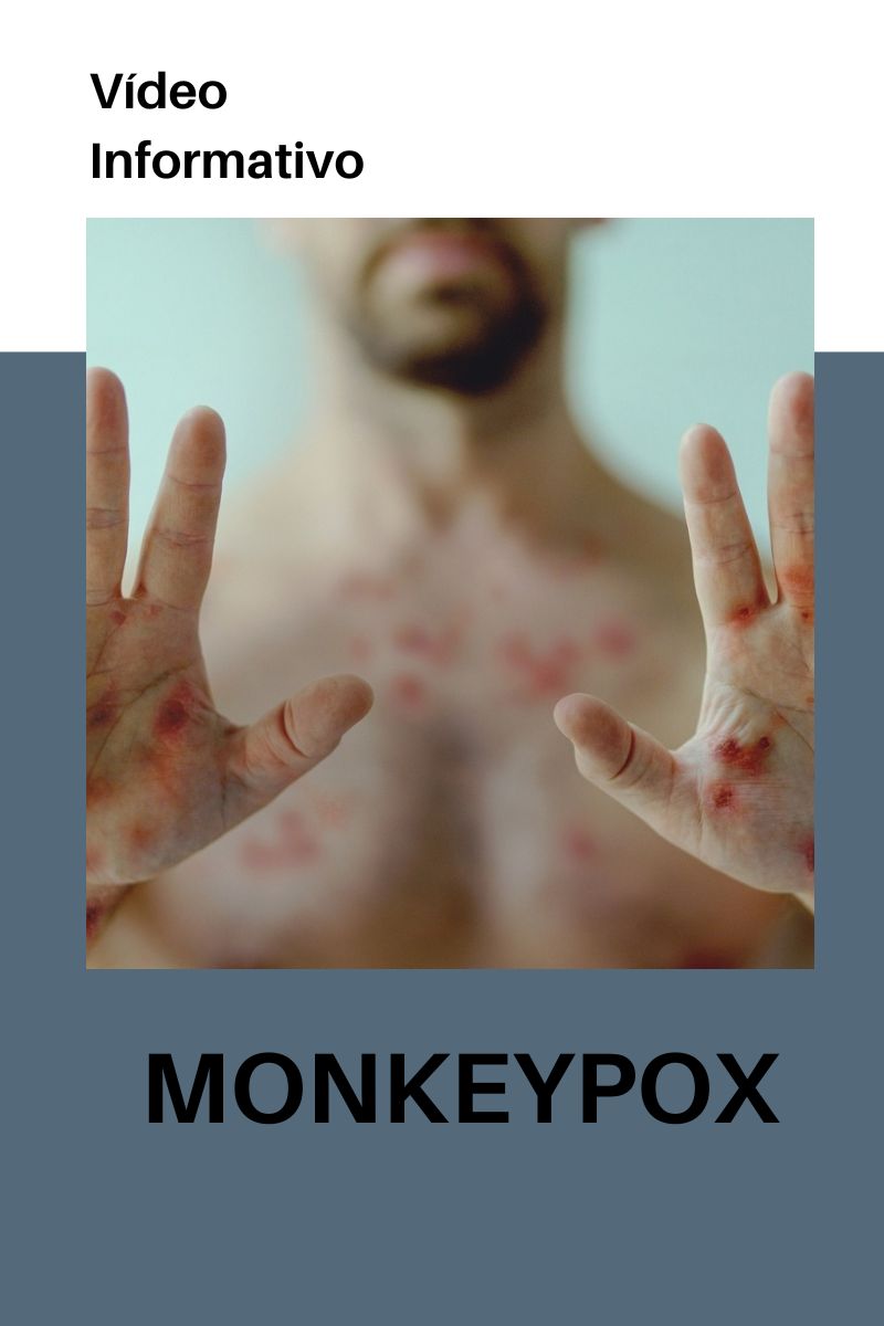 Monkeypox